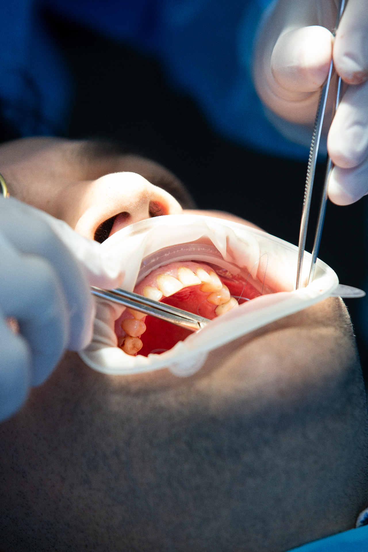 Periodontia