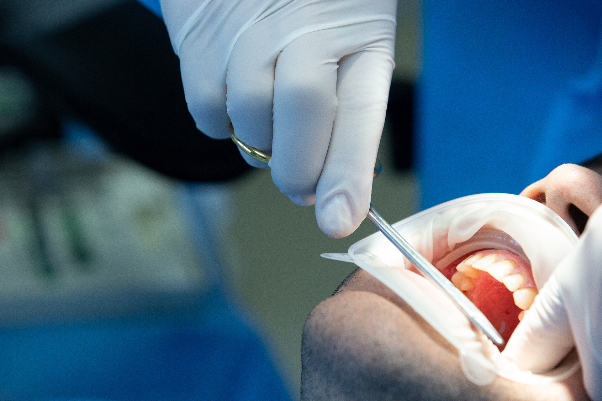 Cirurgia Oral e Bucomaxilofacial