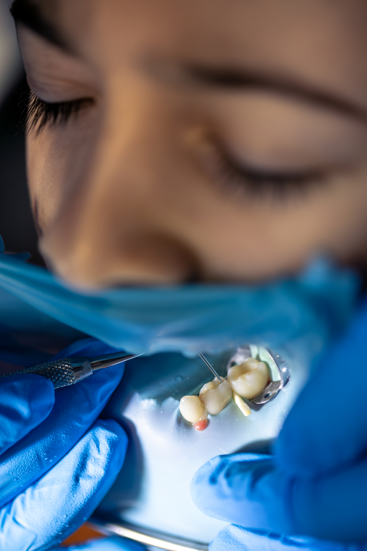 Dentística Restauradora