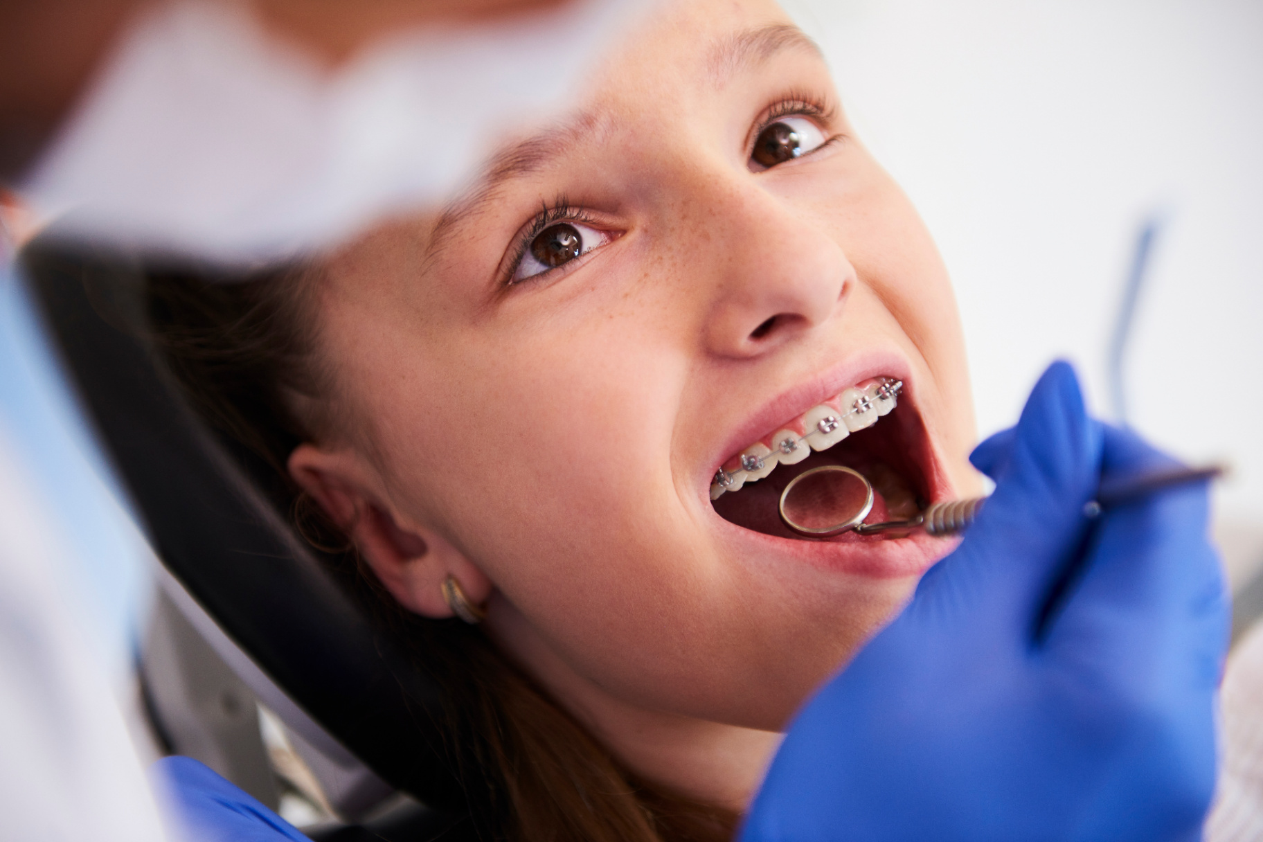 Ortodontia / Invisalign